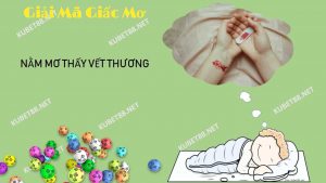 nam-mo-thay-vet-thuong-danh-gi-va-diem-bao-gi